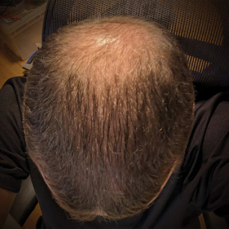 Richard, Germany - BEFORE