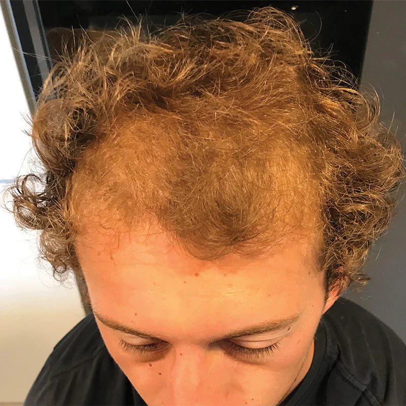 James, Belgium - BEFORE