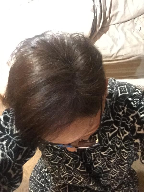 Customer before and after photo