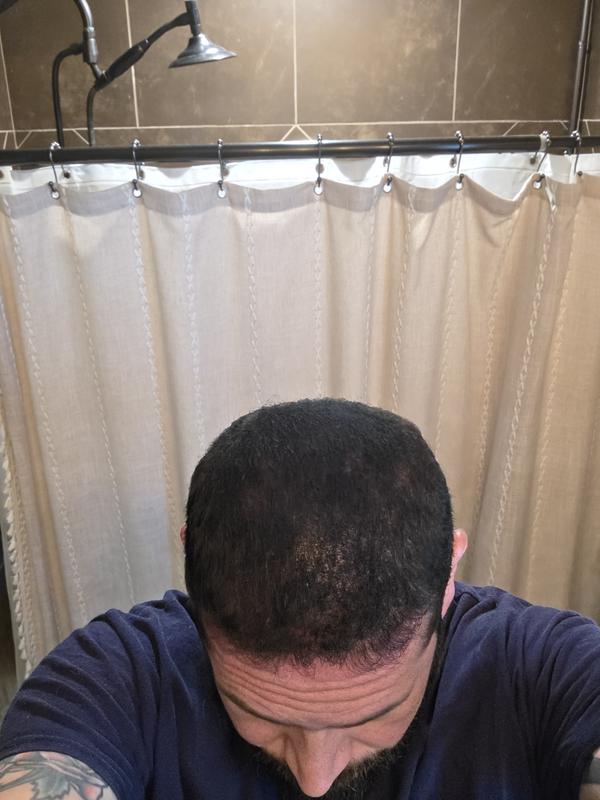Customer before and after photo