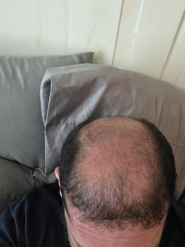 Customer before and after photo