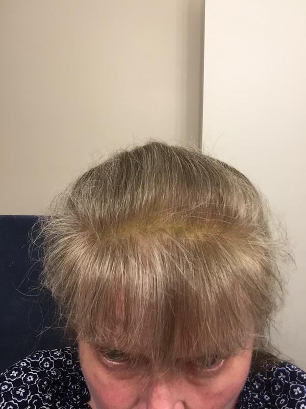 Customer before and after photo