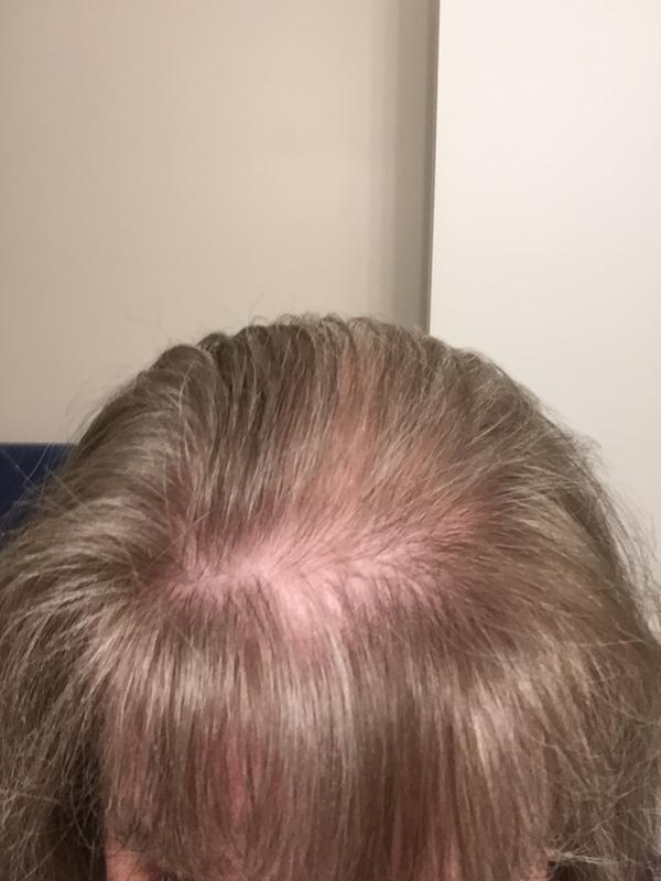 Customer before and after photo