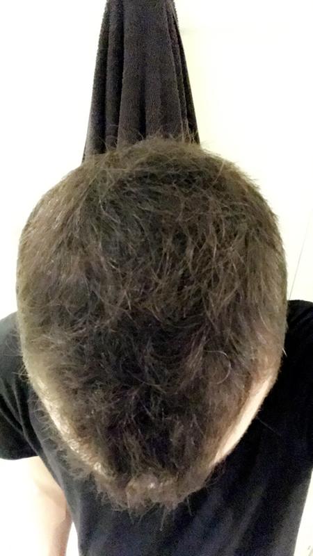 Customer before and after photo