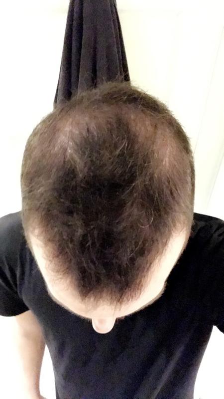 Customer before and after photo