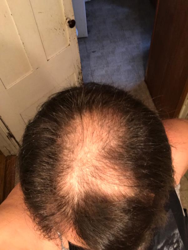 Customer before and after photo