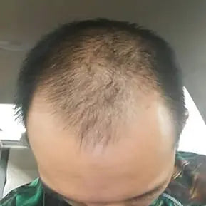 Customer before and after photo