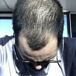 Customer before and after photo