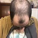 Customer before and after photo