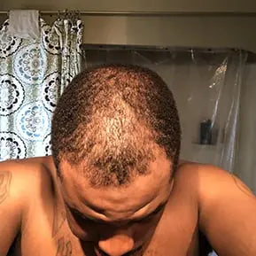 Customer before and after photo