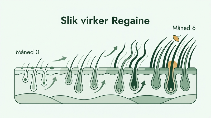 Slik virker Regaine over seks måneder