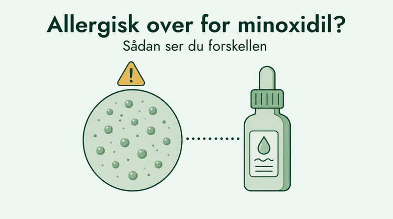 Sådan skelner du en minoxidil-allergi fra almindelig irritation