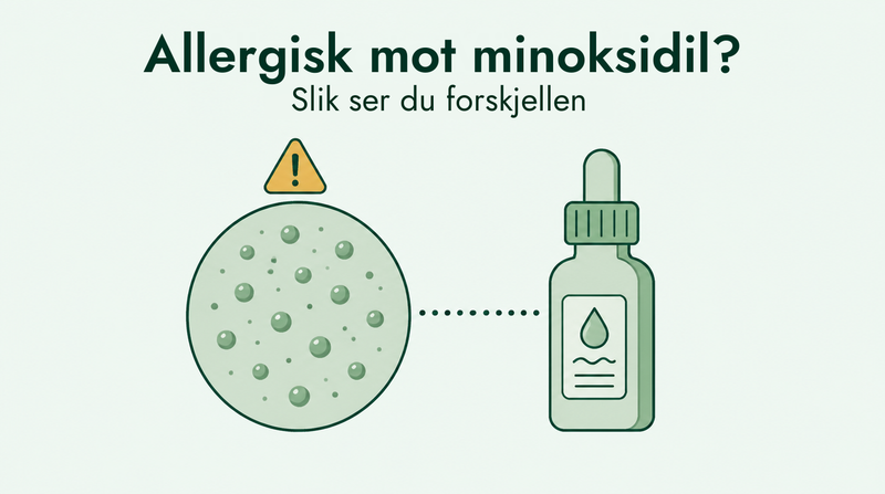 Slik skiller du minoksidilallergi fra irritasjon
