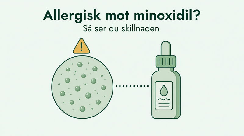 Så skiljer du minoxidilallergi från irritation