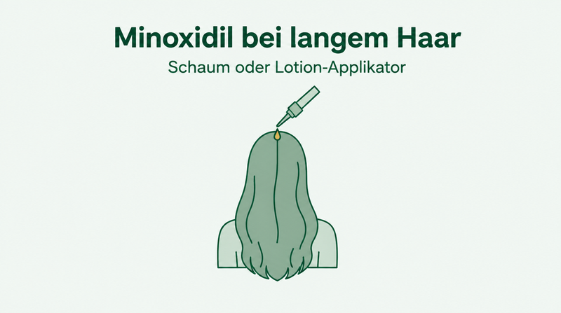 Minoxidil bei langem Haar: Schaum oder Lösung