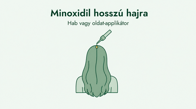 Minoxidil hosszú hajra: hab vagy oldat