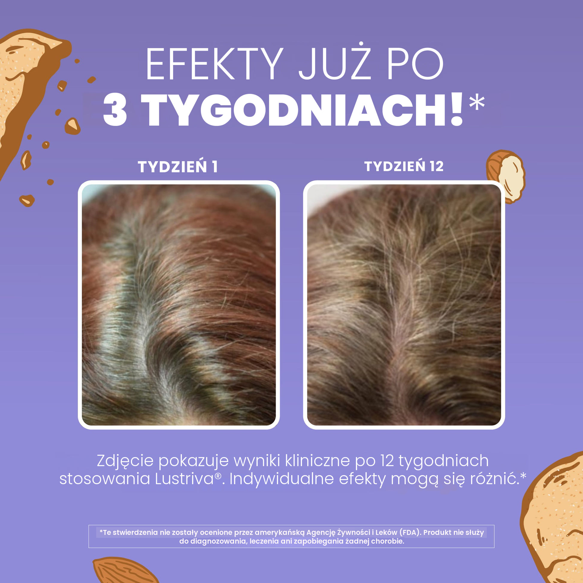 Biotyna w postaci biotynianu magnezu, która wspiera prawidłowy stan włosów i skóry
