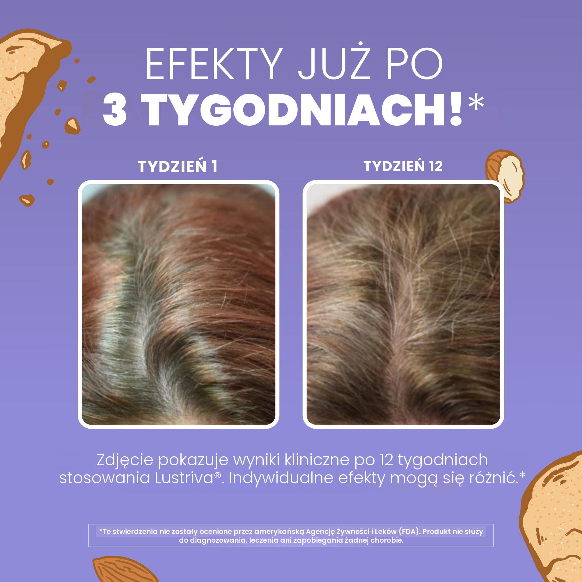 Biotyna w postaci biotynianu magnezu, która wspiera prawidłowy stan włosów i skóry