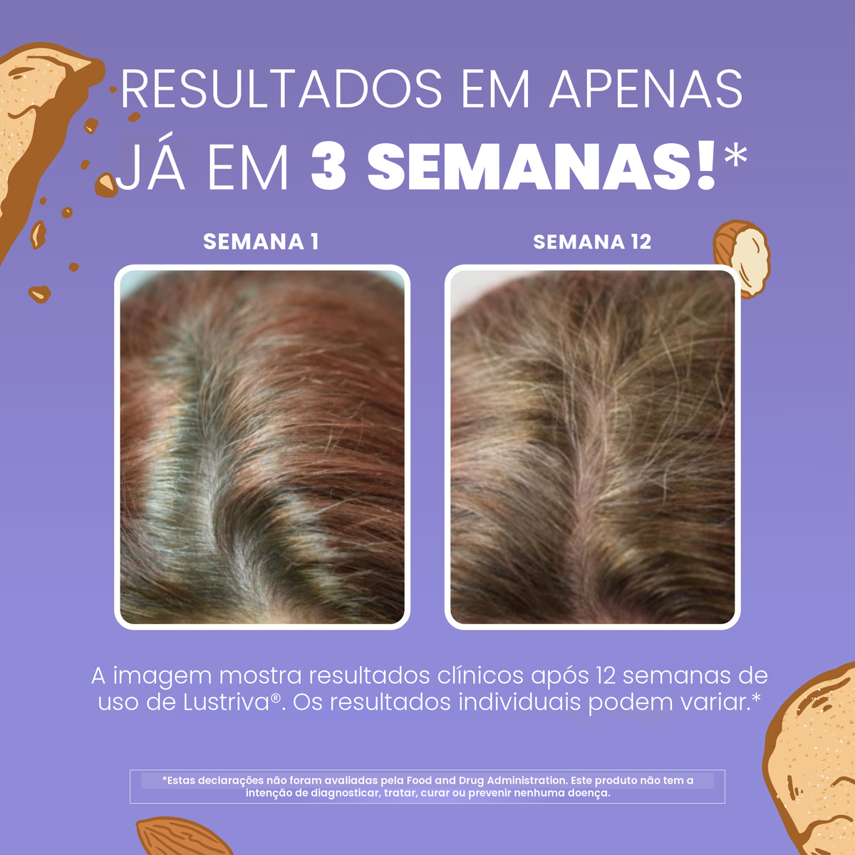 Biotina na forma de biotinato de magnésio, que contribui para cabelo e pele normais