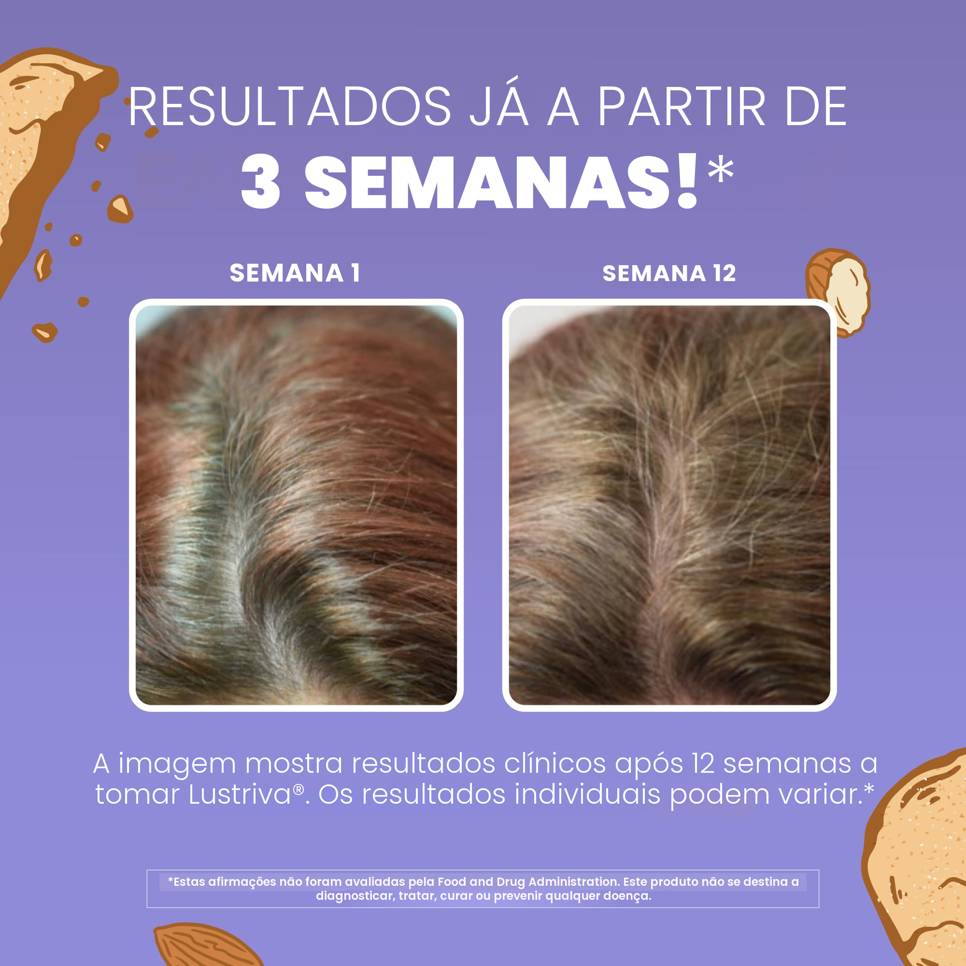 Biotina sob a forma de biotinato de magnésio, que contribui para o cabelo e a pele normais