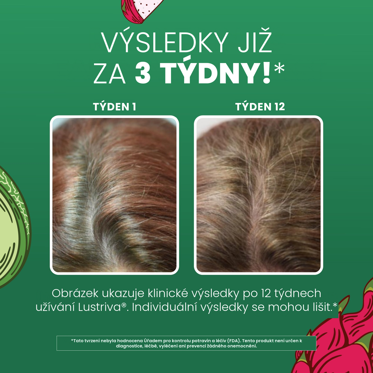Klinická obrazová dokumentace MaryRuth Organics pro Lustriva, srovnání vlasů v 1. a 12. týdnu