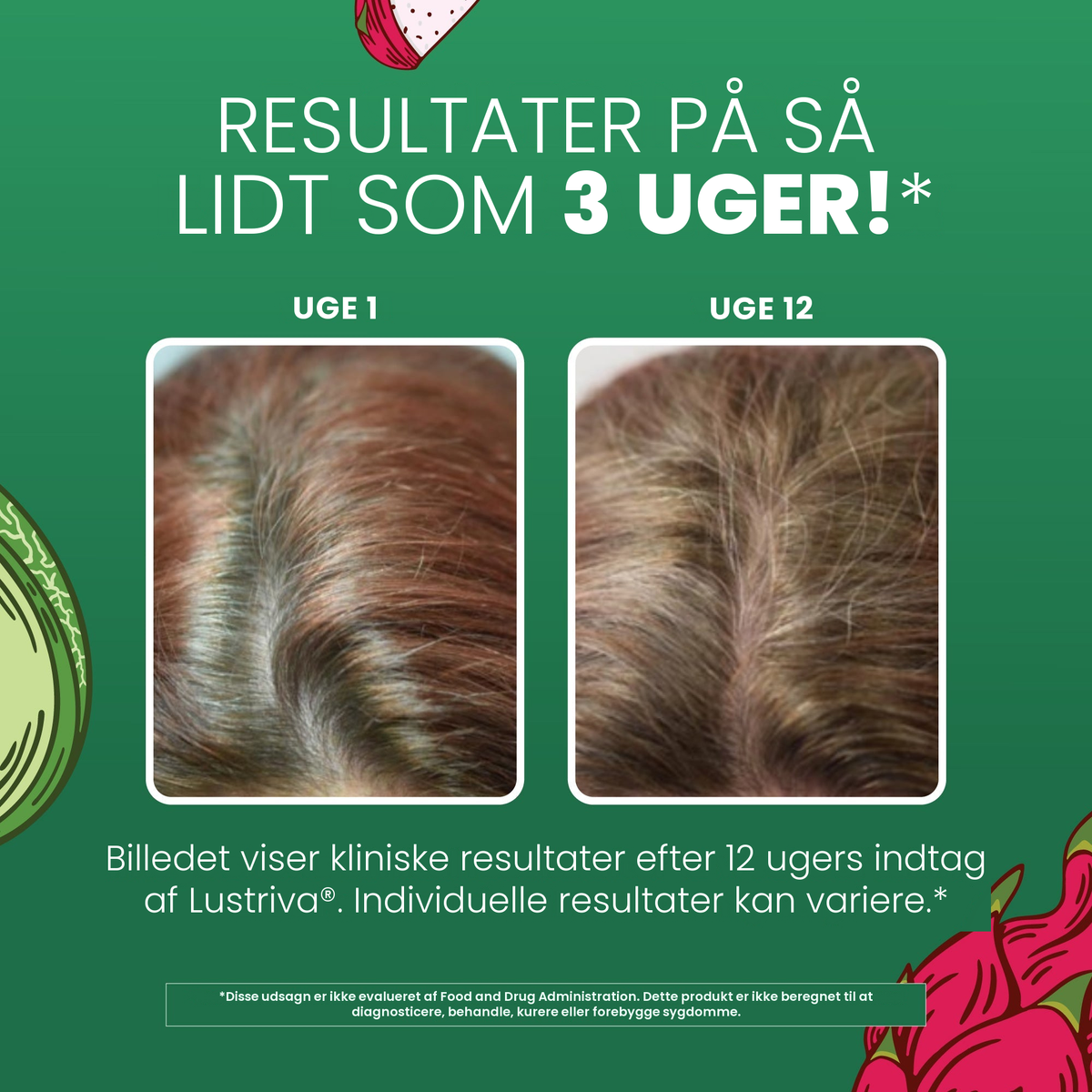 MaryRuth Organics' kliniske billeder for Lustriva, der viser håret i uge 1 sammenlignet med uge 12