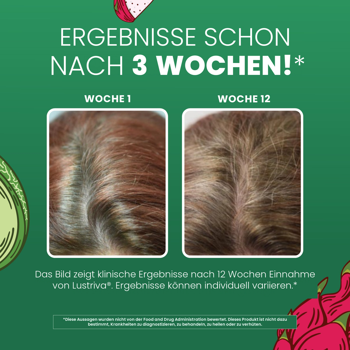 Klinische Aufnahmen von MaryRuth Organics zu Lustriva: Haar in Woche 1 neben Woche 12