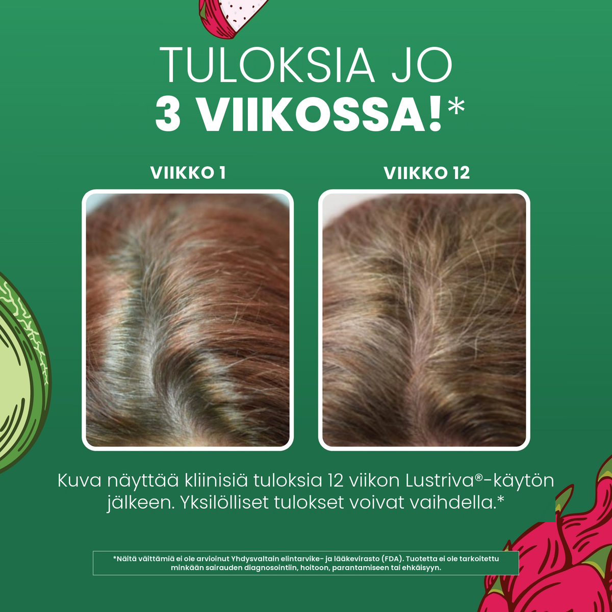 MaryRuth Organicsin kliininen kuvamateriaali Lustrivasta, hiukset viikolla 1 verrattuna viikkoon 12