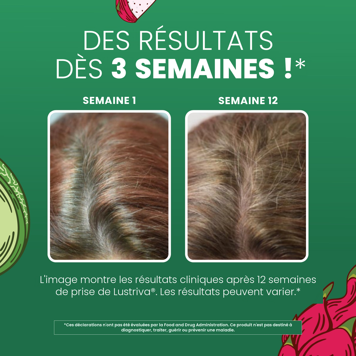 Images cliniques MaryRuth Organics pour Lustriva : cheveux à la semaine 1 à côté de la semaine 12