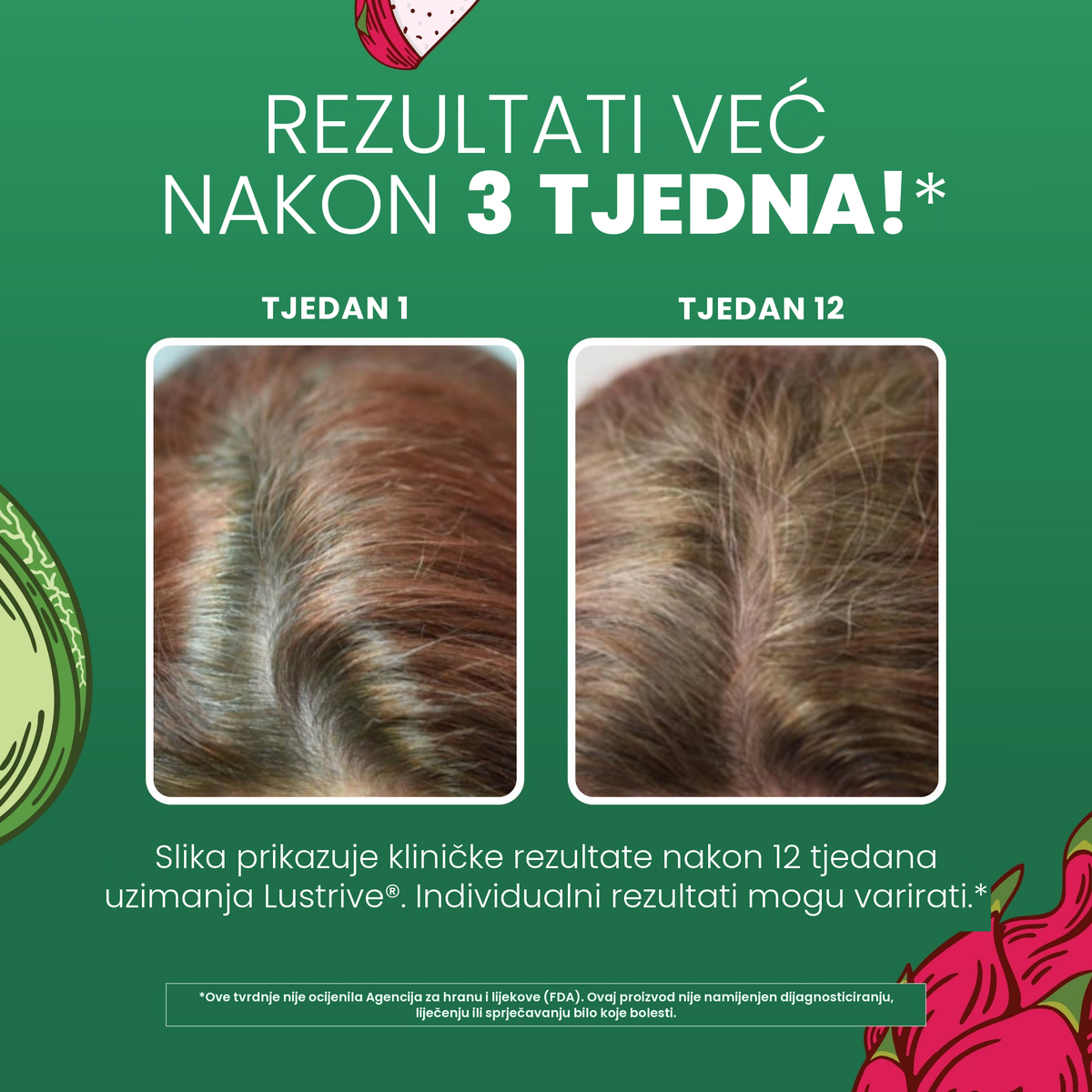 MaryRuth Organics klinički prikaz za Lustriva, kosa u 1. tjednu naspram 12. tjedna