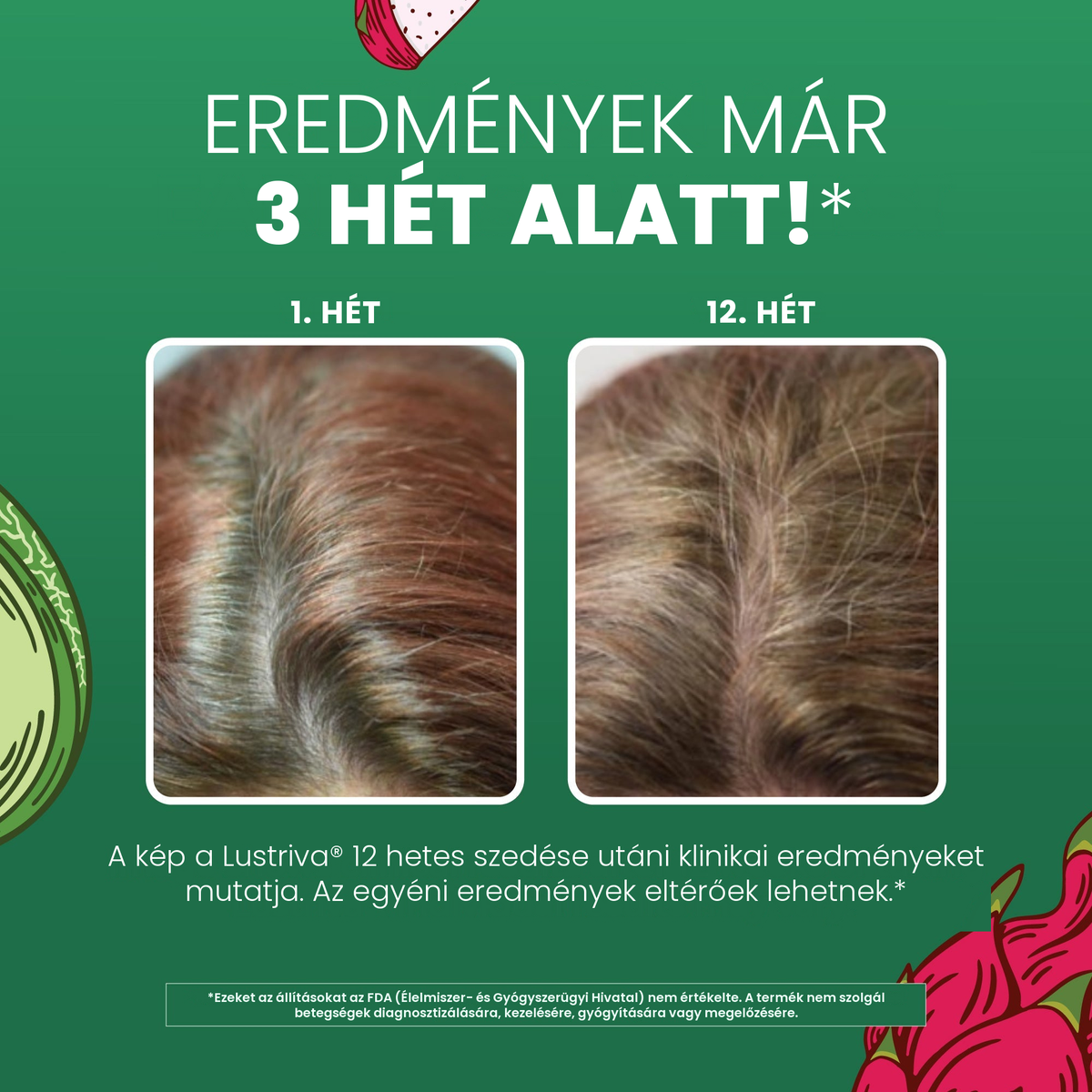 MaryRuth Organics klinikai fotódokumentáció a Lustriva termékhez, 1. hét és 12. hét összehasonlításban