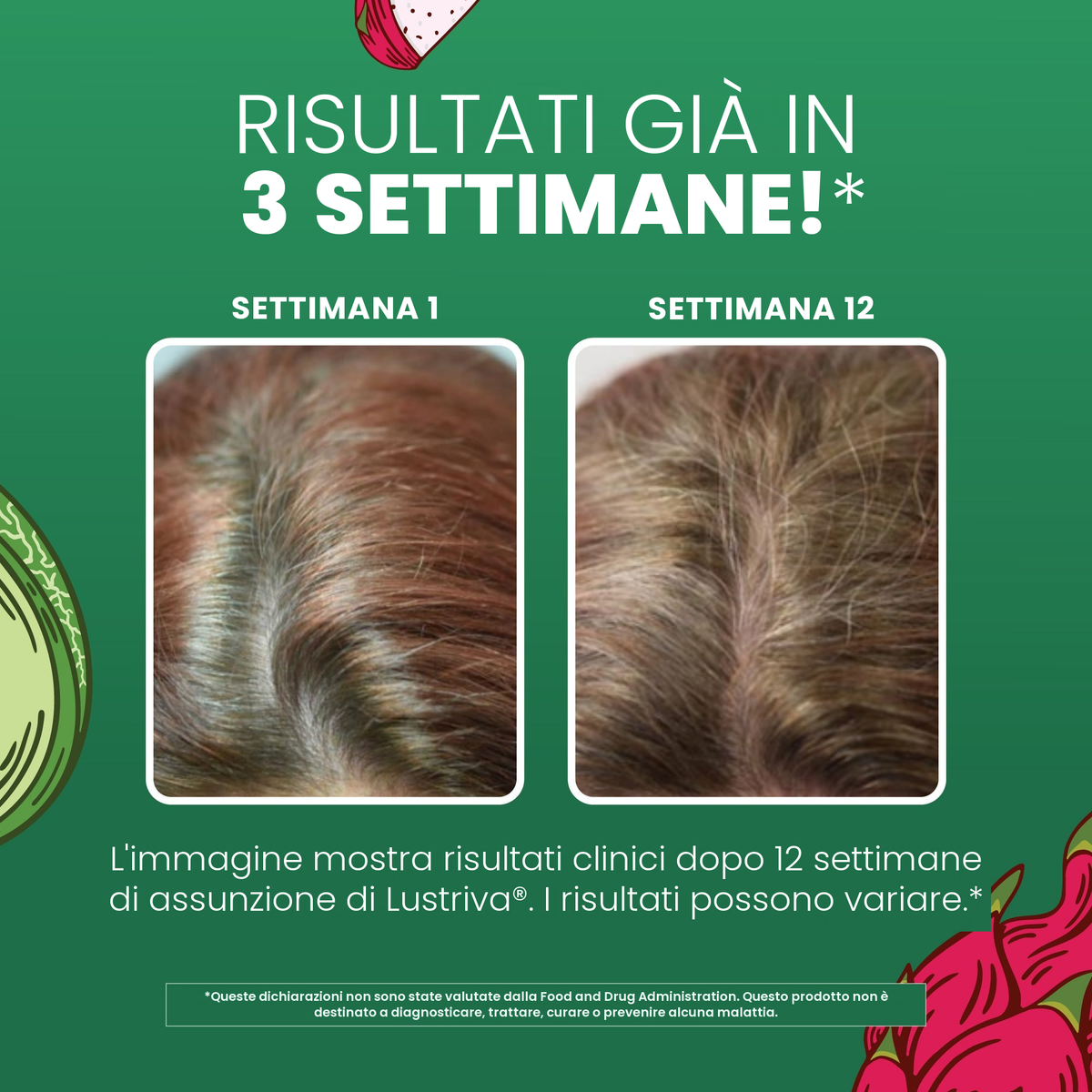 Immagini cliniche MaryRuth Organics per Lustriva: capelli alla settimana 1 accanto alla settimana 12