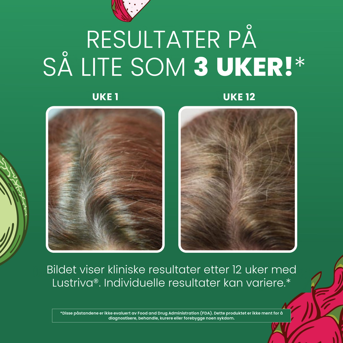 MaryRuth Organics' kliniske bilder for Lustriva, som viser hår ved uke 1 sammenlignet med uke 12