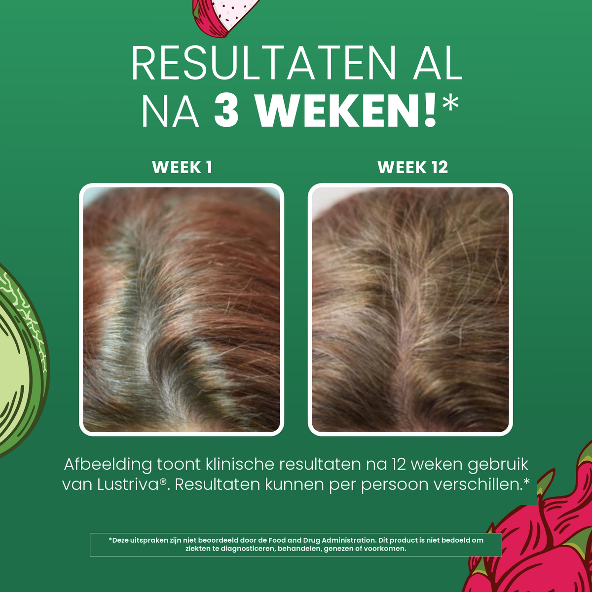 Klinisch beeldmateriaal van MaryRuth Organics voor Lustriva: haar in week 1 naast week 12