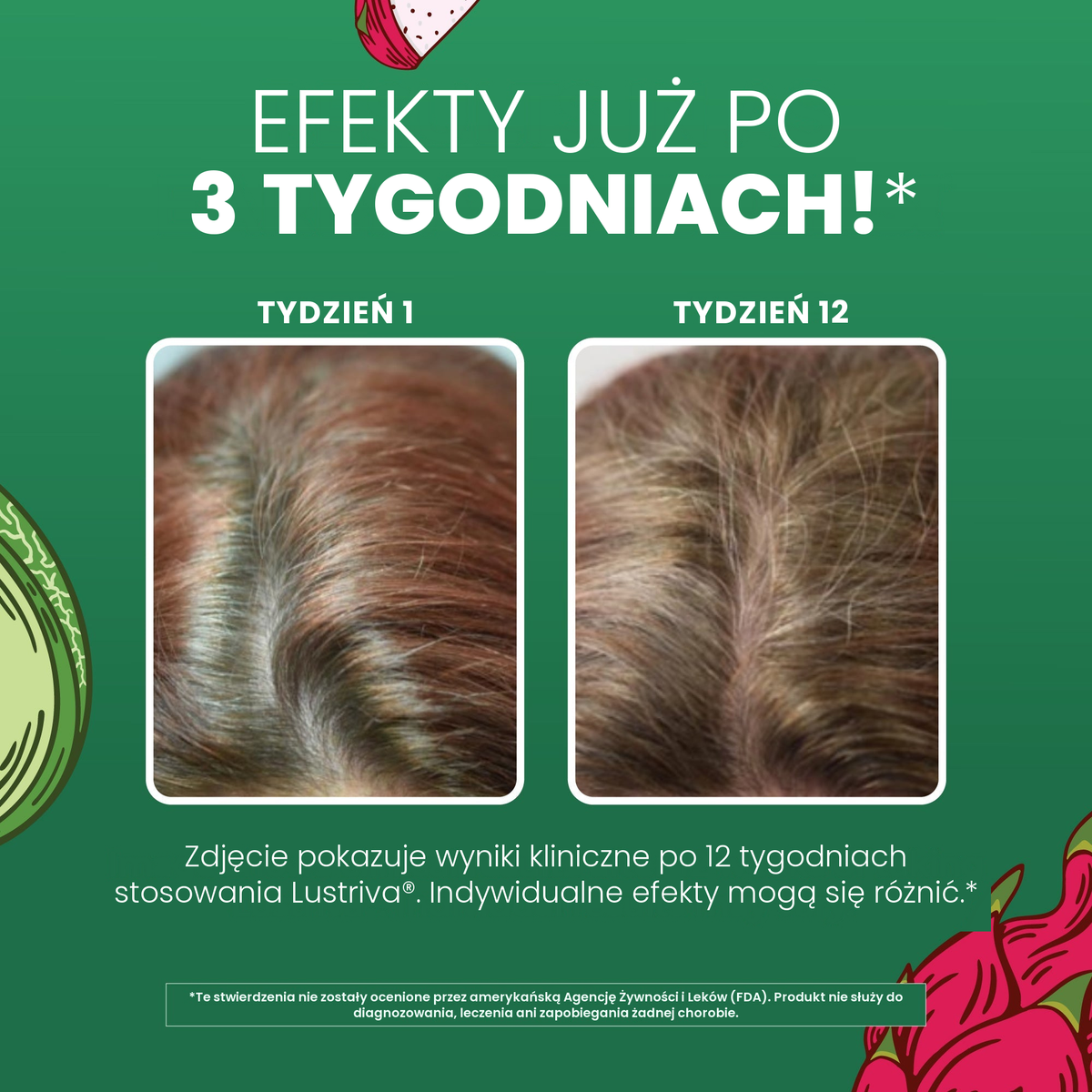 Materiały kliniczne MaryRuth Organics dla Lustriva, porównanie włosów w 1. i 12. tygodniu