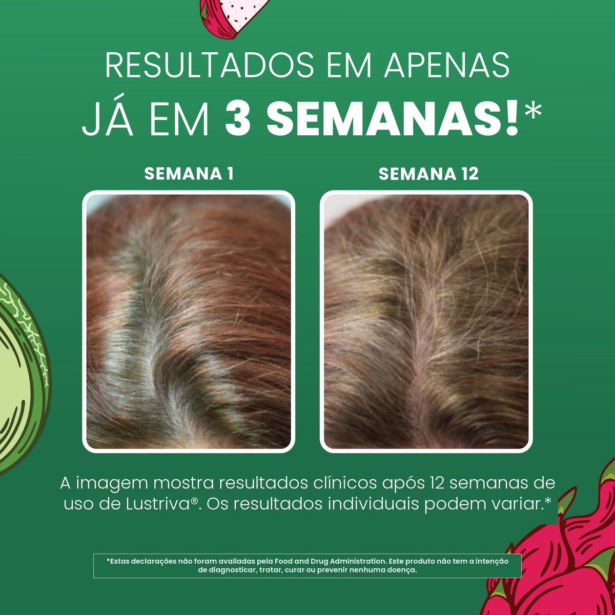 Imagens clínicas da MaryRuth Organics para Lustriva, mostrando o cabelo na semana 1 ao lado da semana 12