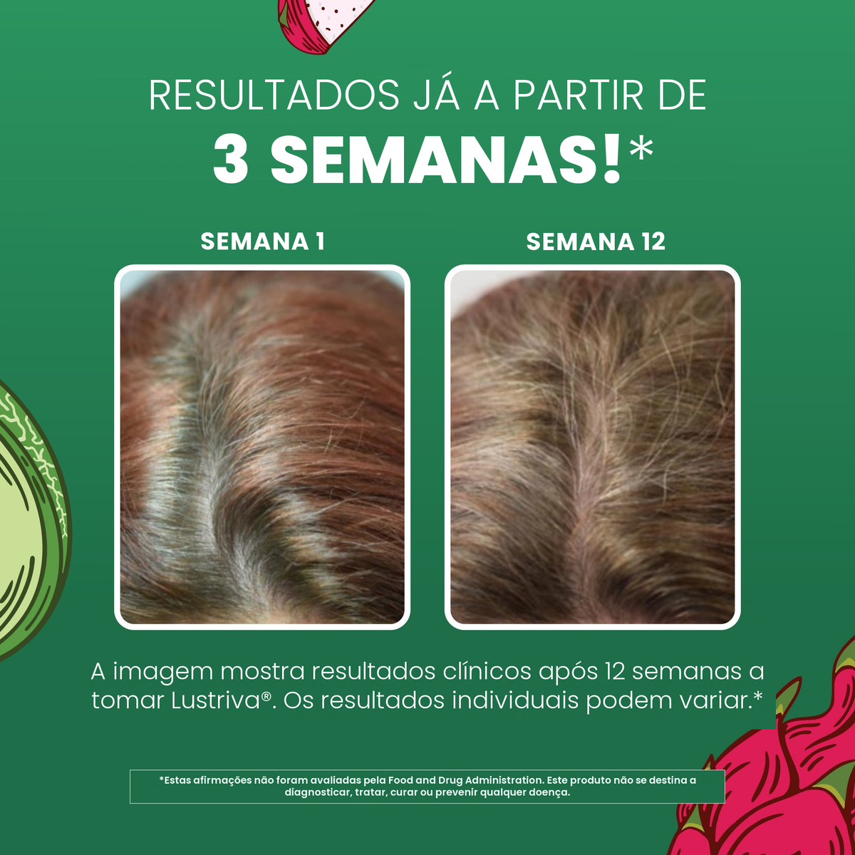Imagens clínicas da MaryRuth Organics para o Lustriva, mostrando o cabelo na semana 1 e na semana 12