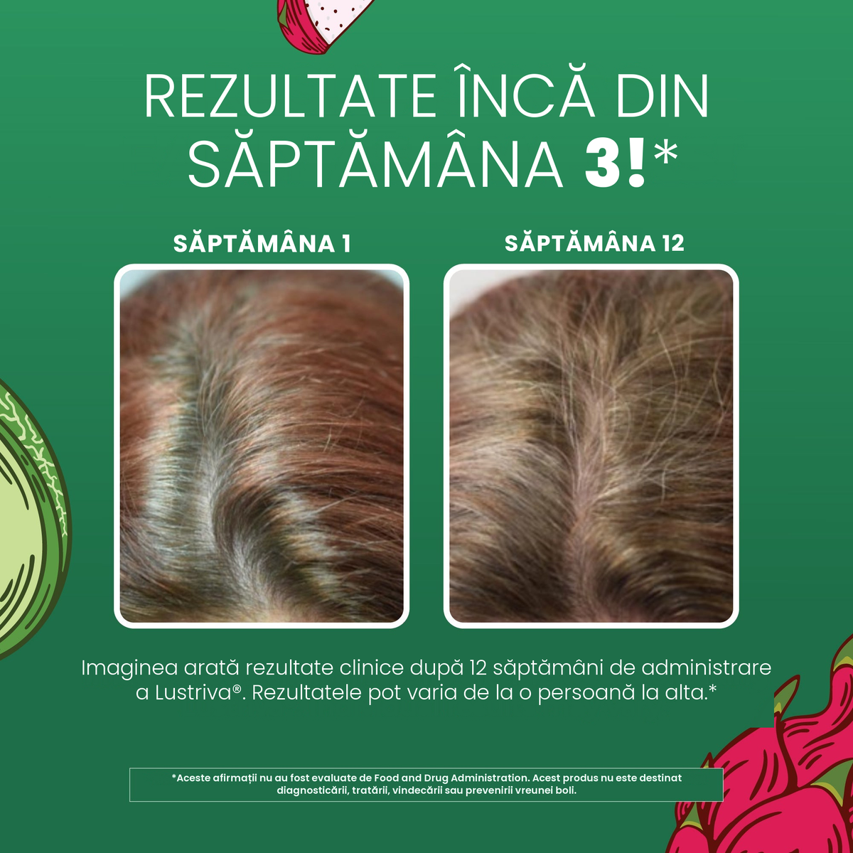 Imagini clinice MaryRuth Organics pentru Lustriva, care arată părul în săptămâna 1 comparativ cu săptămâna 12