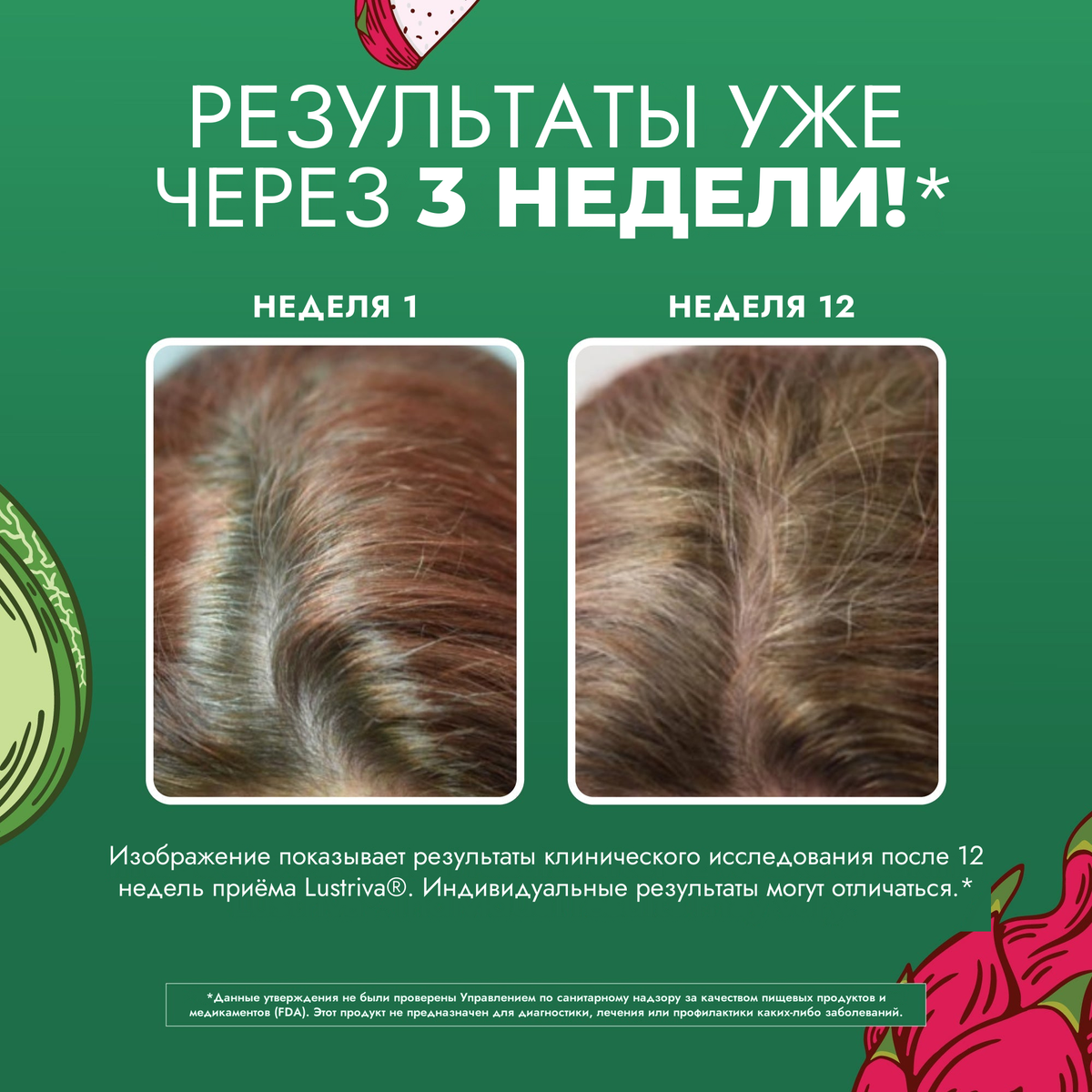 Клинические фото MaryRuth Organics для Lustriva — волосы на 1-й неделе и на 12-й