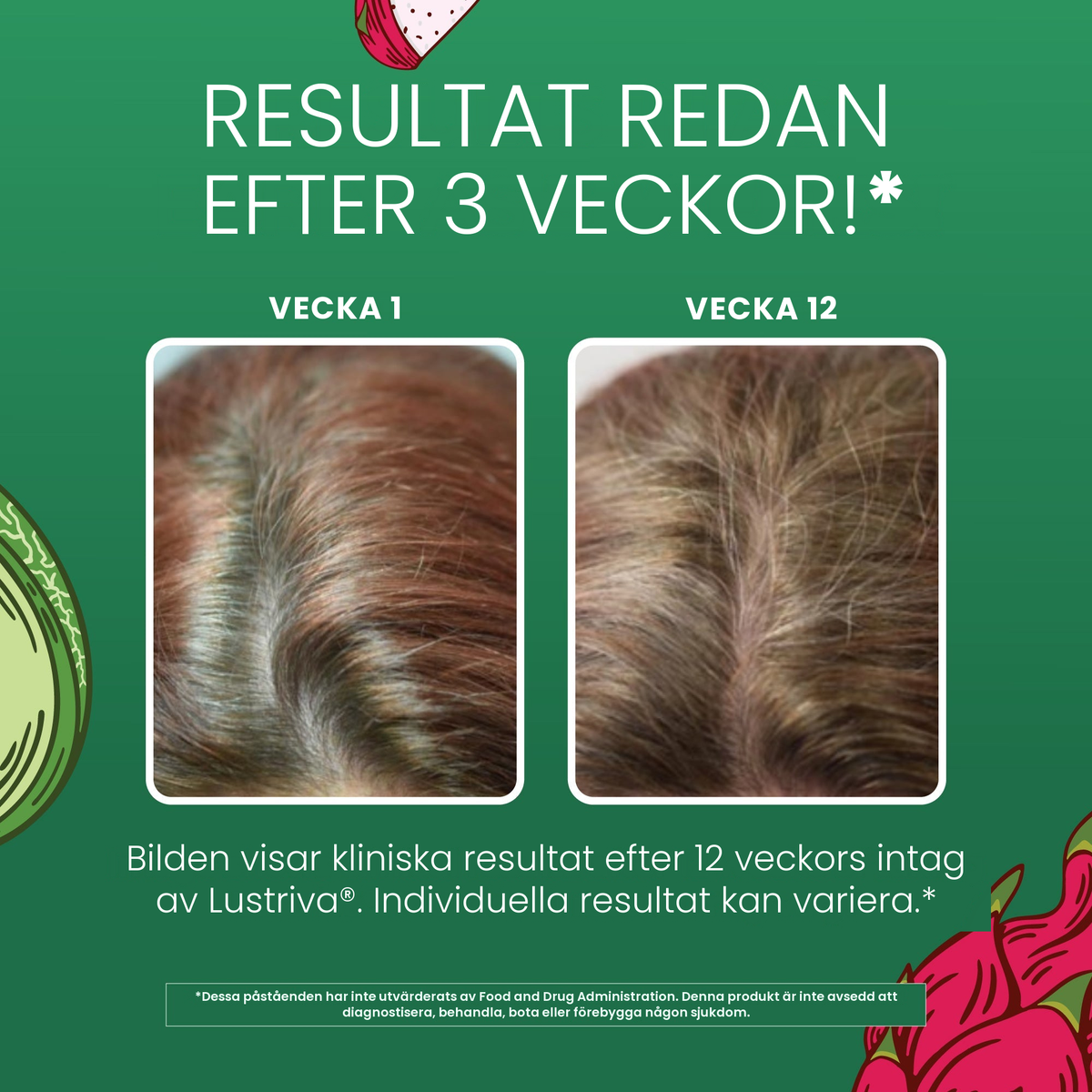 MaryRuth Organics kliniska bilder för Lustriva, hår vecka 1 jämfört med vecka 12