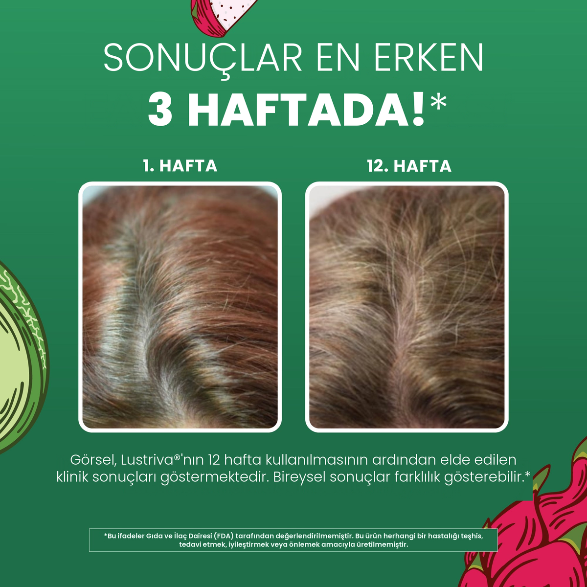 Lustriva için MaryRuth Organics klinik görselleri, 1. hafta ile 12. hafta karşılaştırmalı saç görünümü