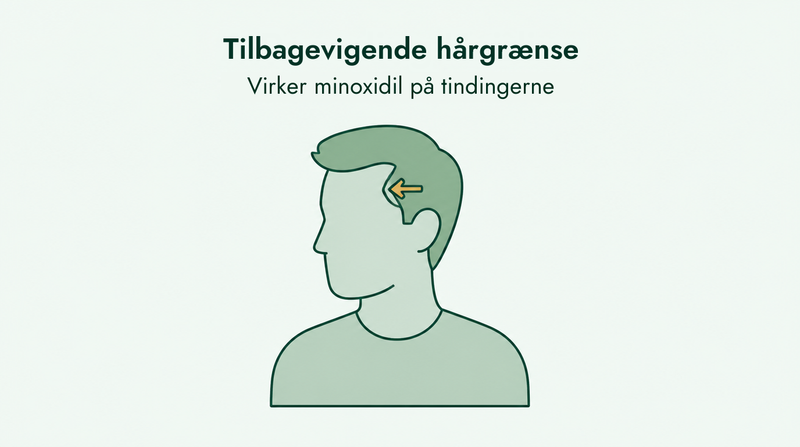 Virker minoxidil på en vigende hårgrænse
