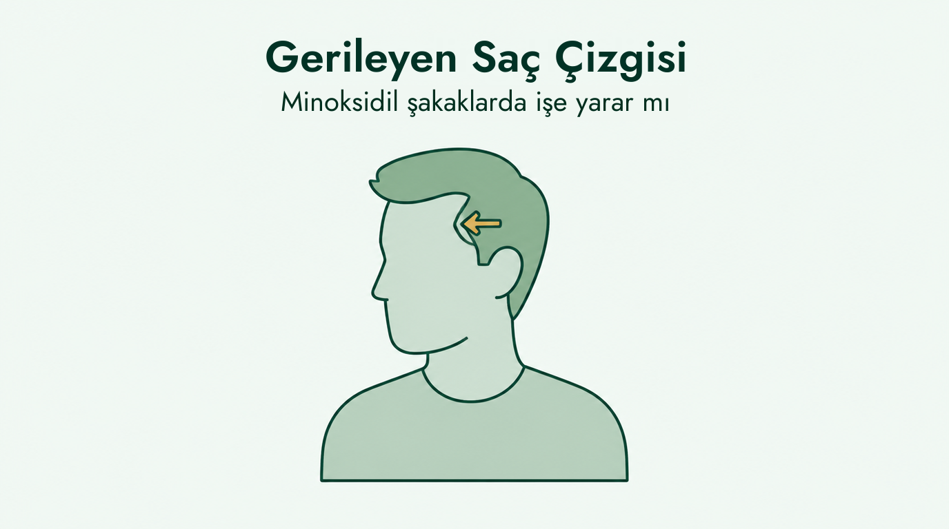 Minoksidil gerileyen saç çizgisinde işe yarar mı