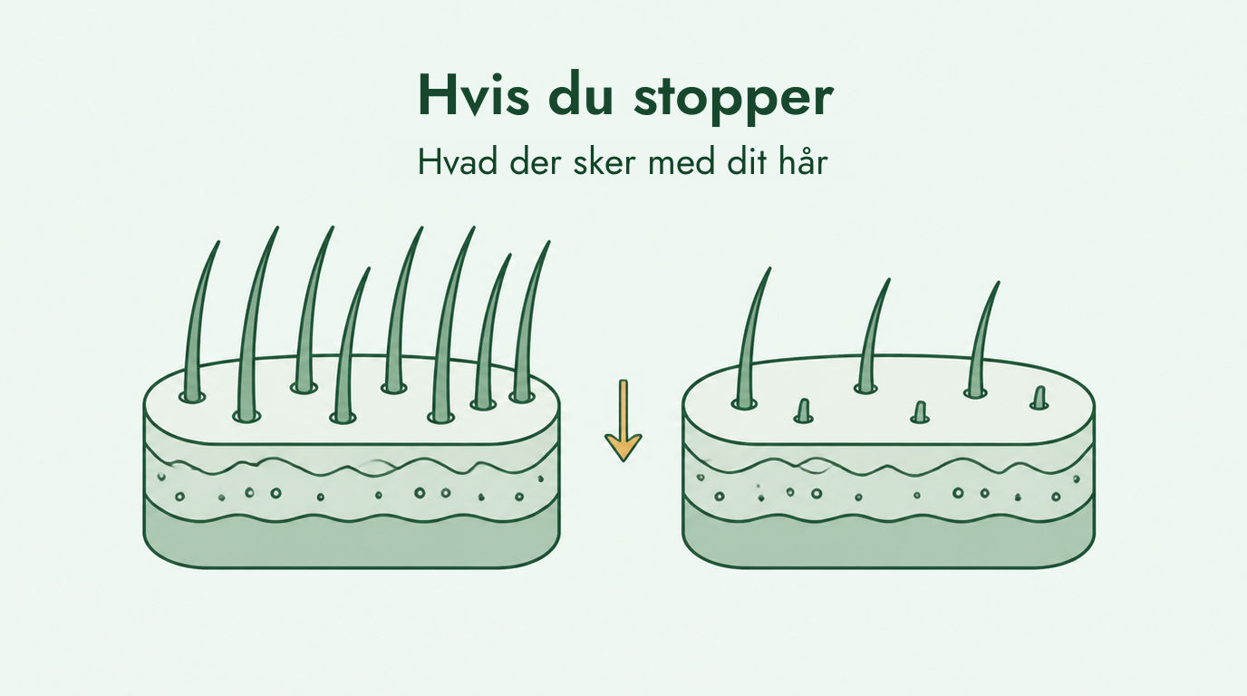 Hvad sker der, når du stopper med minoxidil