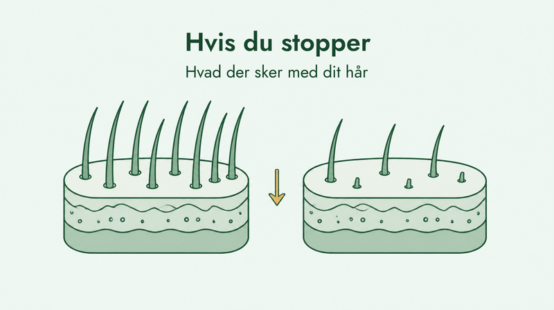 Hvad sker der, når du stopper med minoxidil