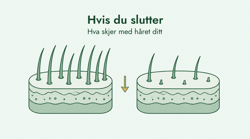 Hva skjer når du slutter å bruke minoksidil